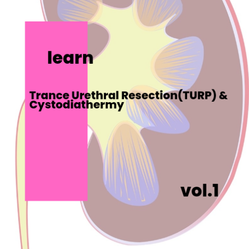 Trance Urethral Resection of Bladder Tumor (TURBT) & Cystodiathermy.