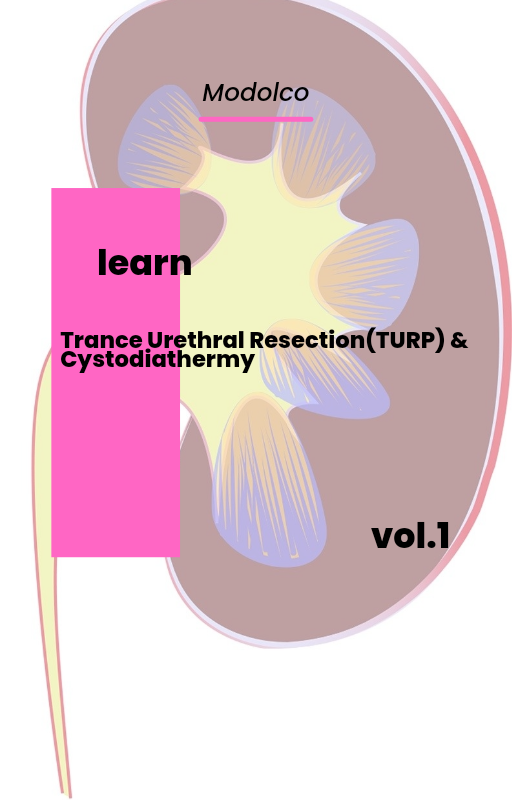 Trance Urethral Resection of Bladder Tumor (TURBT) & Cystodiathermy.